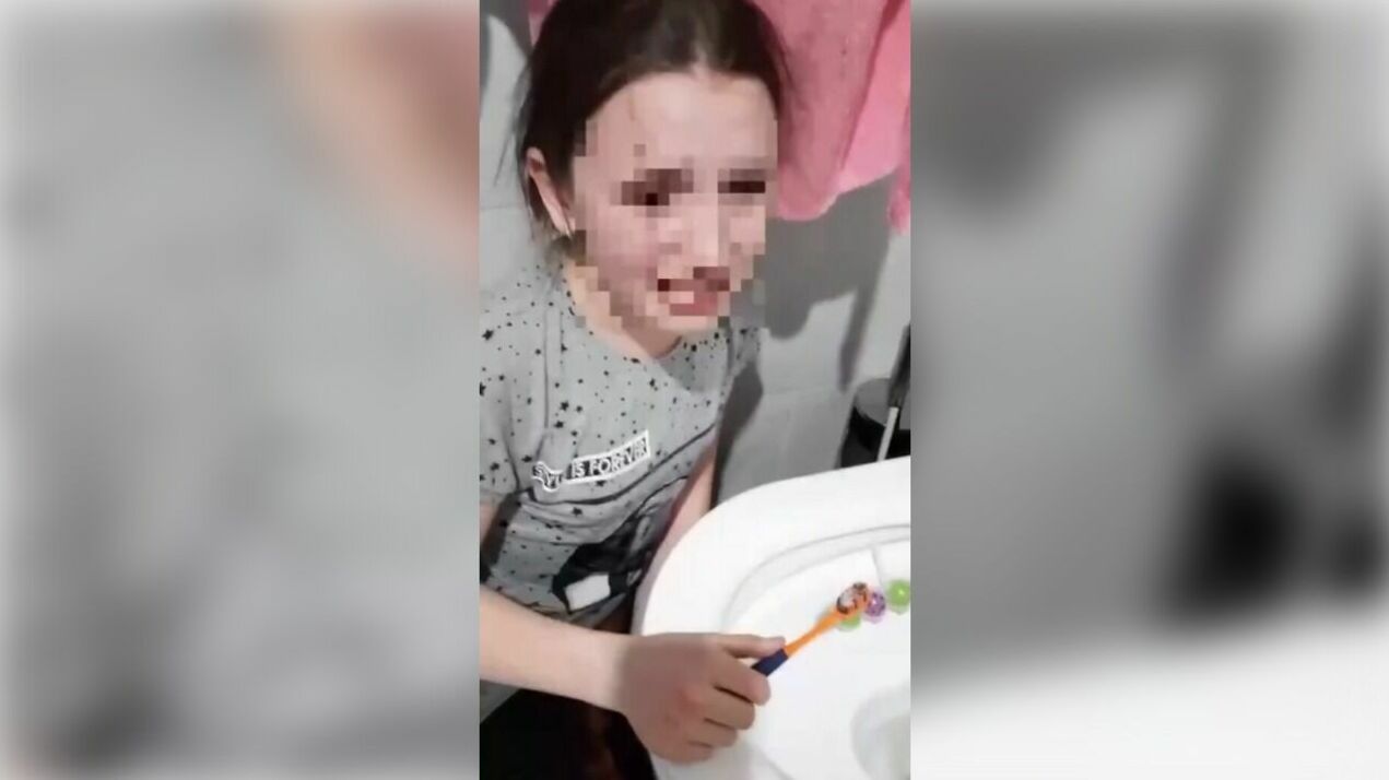 МВД ищет в Ростовской области мать, заставившую дочь чистить зубы водой из унитаза